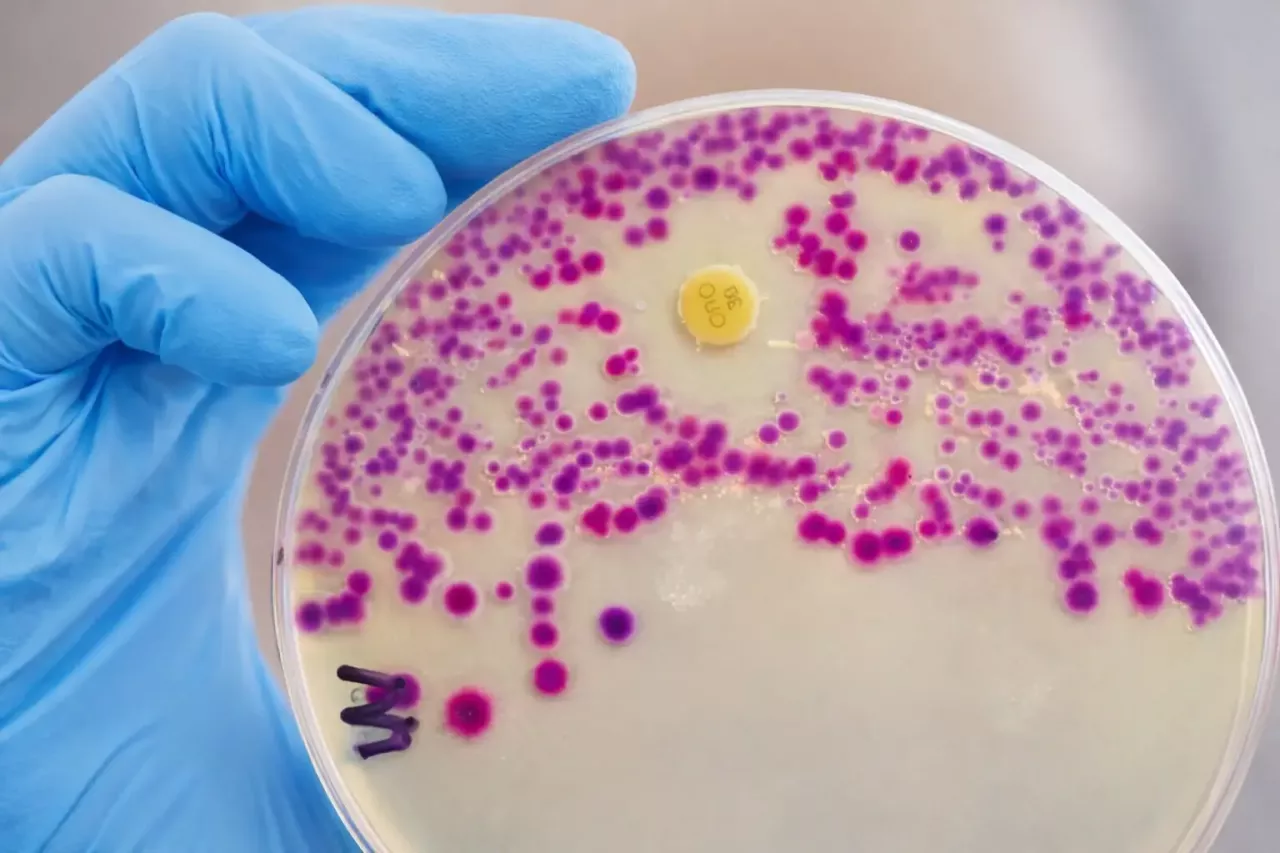 Невидимые воины против бактерий – что такое антибиотики с какой целью их применяют