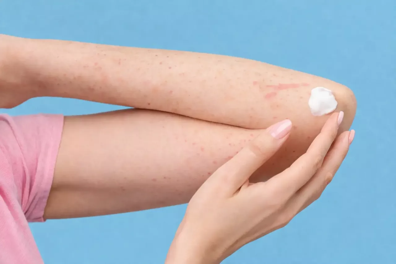 через сколько проявляется аллергия на антибиотики